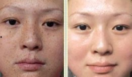 徒手祛斑爆料视频教程,跟随视频教程轻松告别斑点困扰